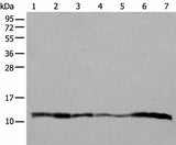 Western blot analysis of 293T A549 Hela and 231 cell Human placenta tissue HEPG2 cell Human fetal liver tissue lysates using UQCRQ Polyclonal Antibody at dilution of 1:400