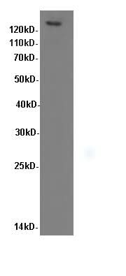 Western Blot analysis of Hela cells using ITGB1 Polyclonal Antibody at dilution of 1:600
