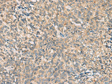 Anti-Human/Mouse CMTM4 Antibody - ABMIUM