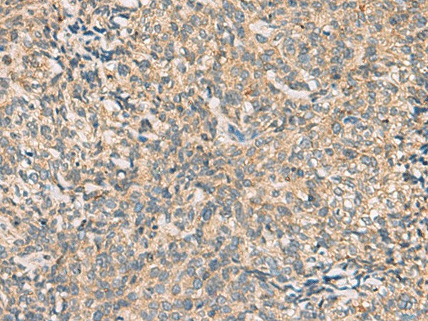 Anti-Human/Mouse CMTM4 Antibody - ABMIUM