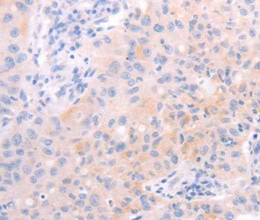 Anti-Human/Mouse/Rat AMH Antibody