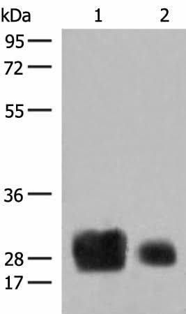 Western blot analysis of Human spleen tissue and A375 cell lysates using HLA-DRB1 Polyclonal Antibody at dilution of 1:500