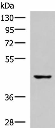 Anti-Human TNFRSF10D Antibody - ABMIUM
