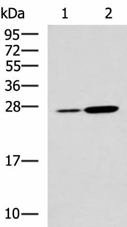 Western blot analysis of Mouse kidney tissue and Mouse liver tissue lysates using NQO2 Polyclonal Antibody at dilution of 1:1000