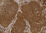 Anti-Human NME1 Antibody [A1177] - ABMIUM