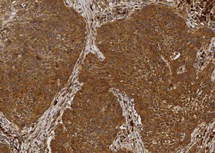 Anti-Human NME1 Antibody [A1177] - ABMIUM