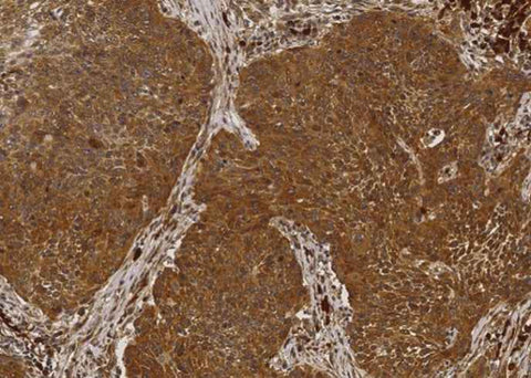 Anti-Human NME1 Antibody [A1177] - ABMIUM