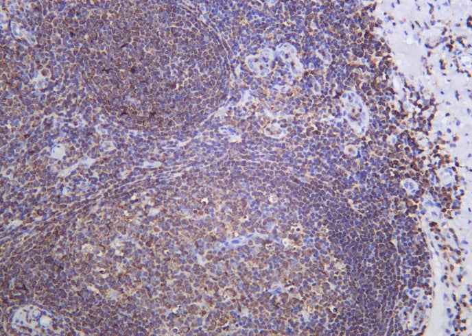 Anti-Human/Mouse/Rat SH-PTP1 Antibody [B952]