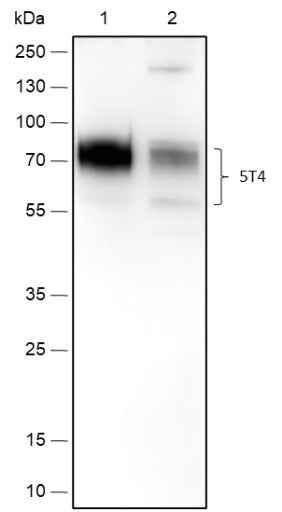 Anti-Human 5T4 Antibody [A473] - ABMIUM