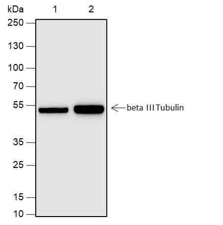 Anti-Human/Rat/Mouse beta III Tubulin Antibody [A651] - ABMIUM