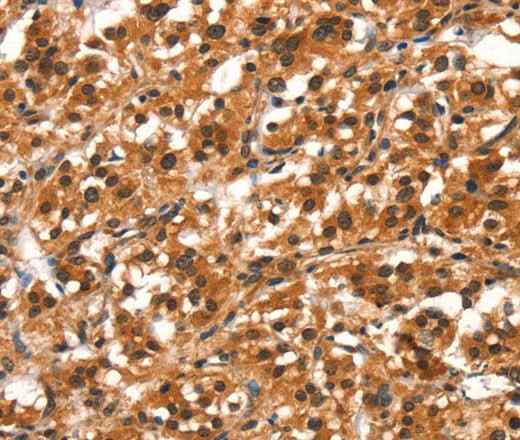 Anti-Human/Mouse/Rat DDX4 Antibody