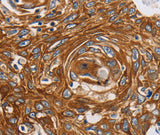 Anti-Human/Mouse/Rat GRIN1 Antibody - ABMIUM