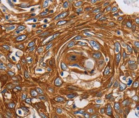Anti-Human/Mouse/Rat GRIN1 Antibody