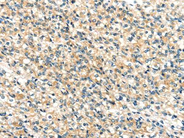 Anti-Human/Mouse TTI1 Antibody