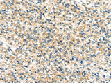 Anti-Human/Mouse TTI1 Antibody - ABMIUM