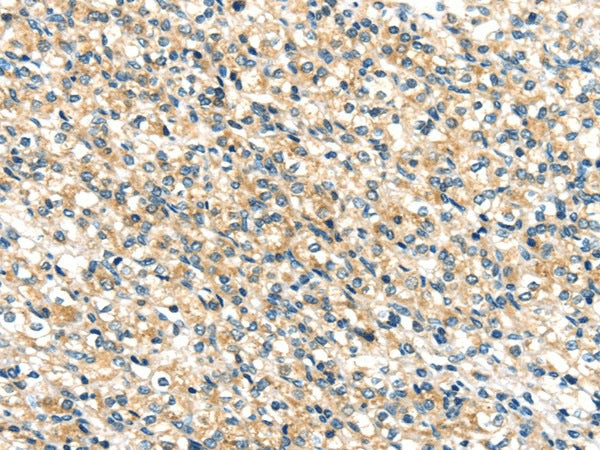 Anti-Human/Mouse TTI1 Antibody - ABMIUM