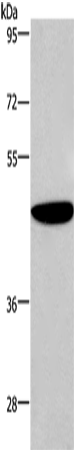 Anti-Human/Mouse/Rat ABI1 Antibody - ABMIUM