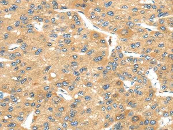 Anti-Human/Mouse UBTD2 Antibody