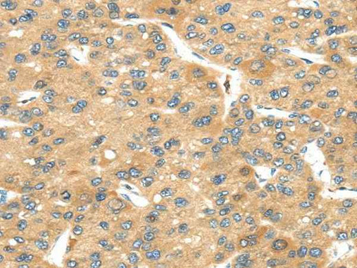 Anti-Human/Mouse UBTD2 Antibody