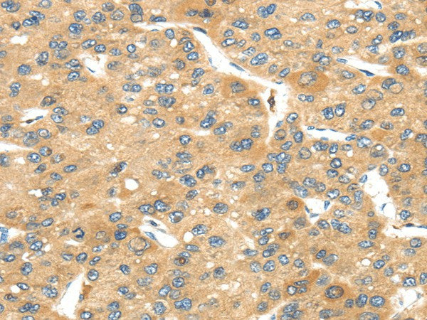 Anti-Human/Mouse UBTD2 Antibody - ABMIUM