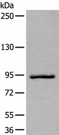 Western blot analysis of Jurkat cell lysate using ZBTB10 Polyclonal Antibody at dilution of 1:800
