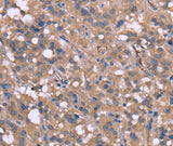 Anti-Human HP Antibody - ABMIUM