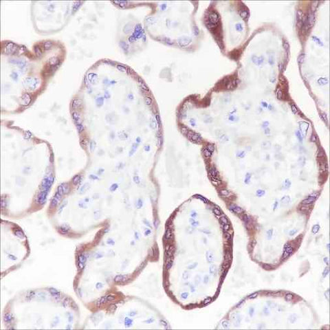 Anti-Human hCG beta Antibody [A243] - ABMIUM