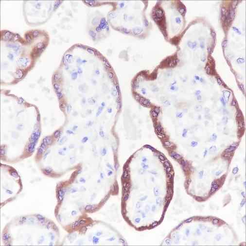 Anti-Human hCG beta Antibody [A243] - ABMIUM