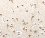Anti-Human/Mouse SEMA3D Antibody - ABMIUM