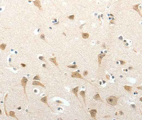 Anti-Human/Mouse SEMA3D Antibody