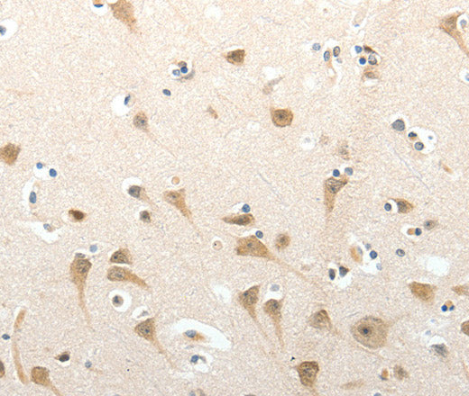Anti-Human/Mouse SEMA3D Antibody - ABMIUM