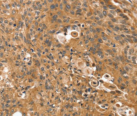 Anti-Human SSX2IP Antibody - ABMIUM
