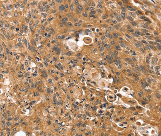 Anti-Human SSX2IP Antibody - ABMIUM