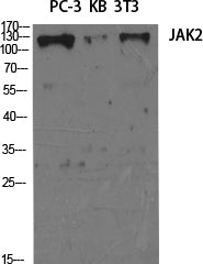 Western Blot analysis of HT-29 cells using JAK2 Polyclonal Antibody at dilution of 1:2000.