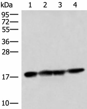 Western blot analysis of 293T HepG2 and Mouse liver tissue lysates using PEMT Polyclonal Antibody at dilution of 1:800