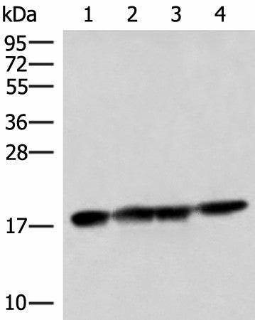Western blot analysis of 293T HepG2 and Mouse liver tissue lysates using PEMT Polyclonal Antibody at dilution of 1:800