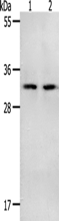 Anti-Human/Mouse/Rat NME6 Antibody - ABMIUM
