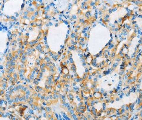 Anti-Human/Mouse ARSA Antibody - ABMIUM