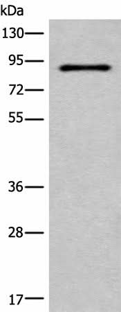 Western blot analysis of HUVEC cell lysate using C7 Polyclonal Antibody at dilution of 1:800