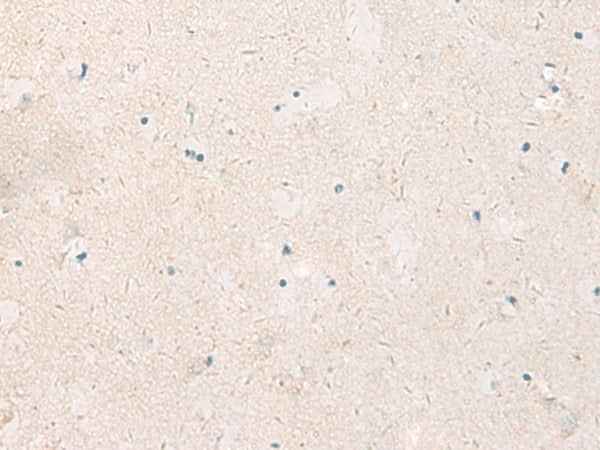Anti-Human/Mouse/Rat KCNIP3 Antibody