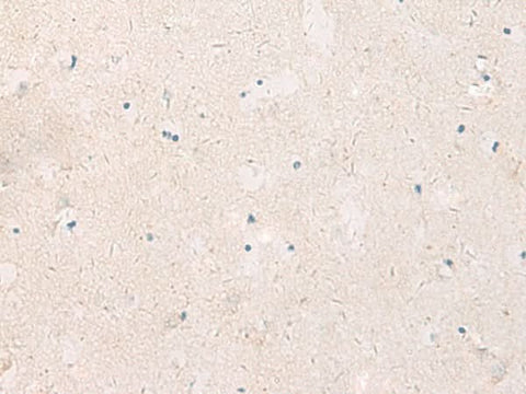 Immunohistochemistry of paraffin-embedded Human brain tissue using KCNIP3 Polyclonal Antibody at dilution of 1:90(×200)