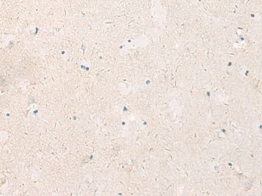 Immunohistochemistry of paraffin-embedded Human brain tissue using KCNIP3 Polyclonal Antibody at dilution of 1:90(×200)
