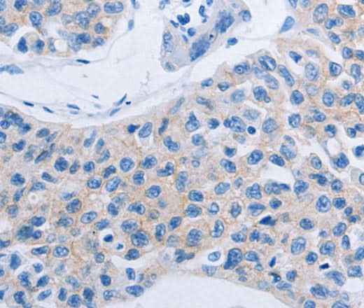 Anti-Human/Mouse HOXA6 Antibody