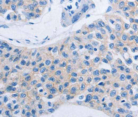 Anti-Human/Mouse HOXA6 Antibody