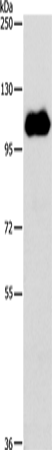 Anti-Human/Rat NOTCH1 Antibody - ABMIUM