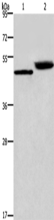 Anti-Human/Mouse/Rat Cathepsin E Antibody - ABMIUM