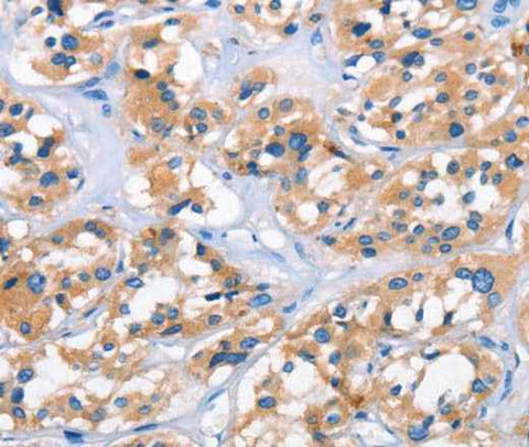 Anti-Human APOL6 Antibody