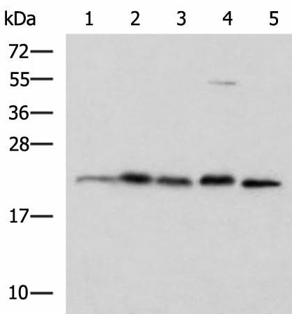 Western blot analysis of A172 HepG2 Hela cell Rat brain tissue and Mouse brain tissue lysates using HPCAL1 Polyclonal Antibody at dilution of 1:1250