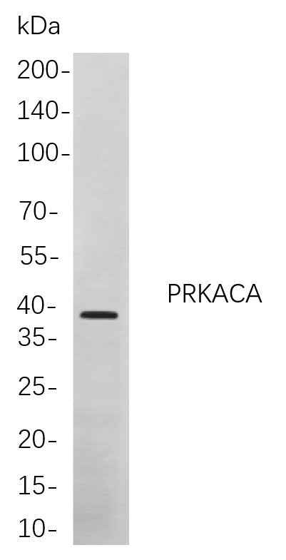 Anti-Human/Mouse/Rat PRKACA Antibody [B874] - ABMIUM