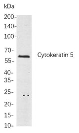 Anti-Human/Mouse/Rat Cytokeratin 5 Antibody [B768]